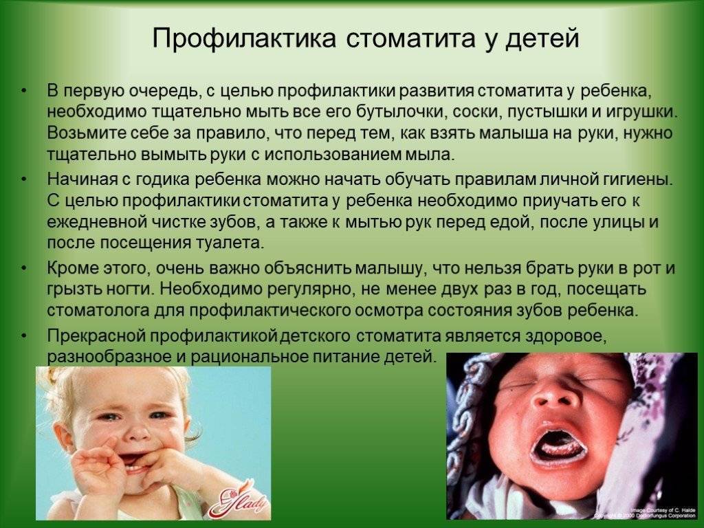 Стоматит у детей: лечение и профилактика, фото