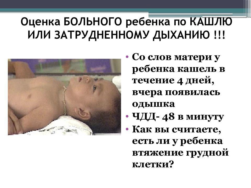 Хриплое дыхание у новорожденных. стридор