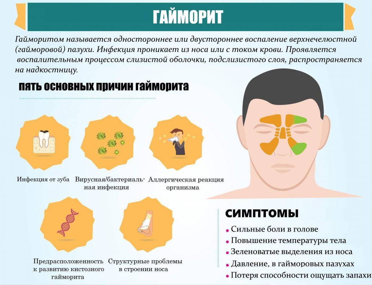 Гайморит у кошек схема лечения