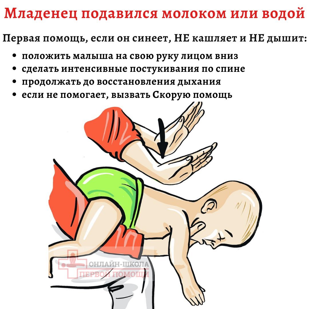 Что делать, если грудничок подавился и задыхается