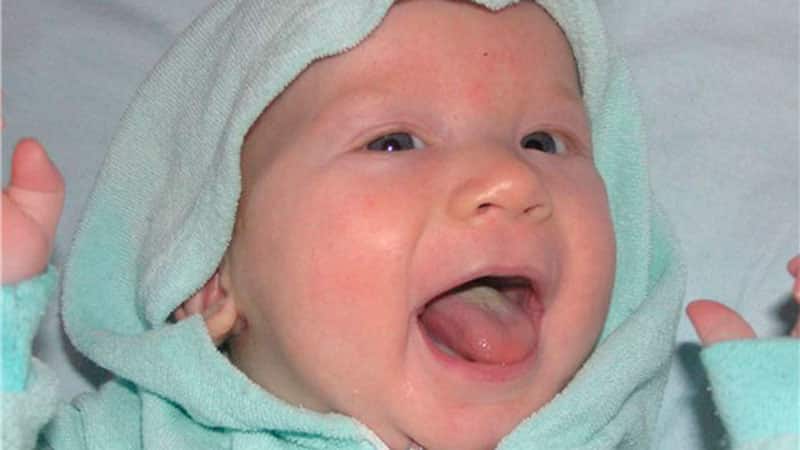 Кандидоз во рту у детей и взрослых: симптомы и лечение молочницы полости рта - стоматология блеск новосибирск