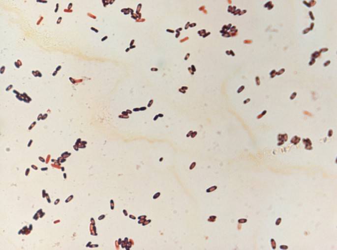 Стеркобилин в кале положительный, реакция на билирубин в кале у грудничка – ваш доктор в онлайне