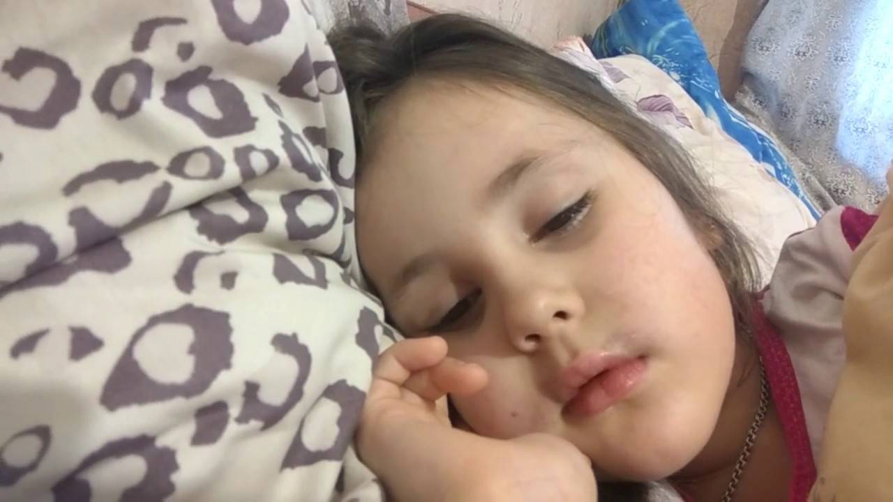 Ребенок спит с приоткрытыми глазами: почему, что делать?
