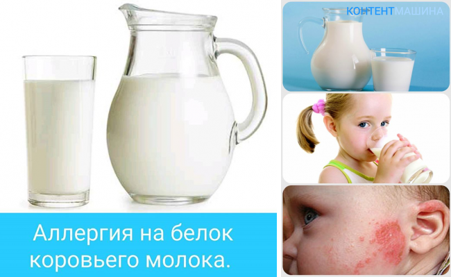 Аллергия на молоко у ребенка: симптомы и диагностика