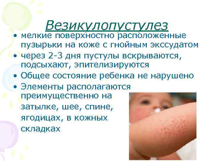 Аллергия у грудного ребенка на лице: как выглядит и чем лечить?