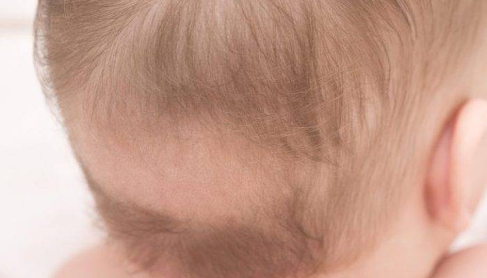 У грудничка плохо растут волосы на голове: жидкие, короткие, тонкие 