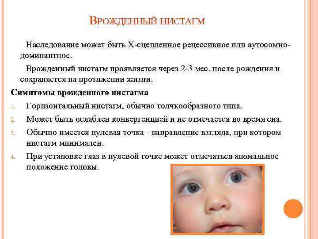 Нистагма - лечение врожденного, вертикального, горизонтального, причины мелкоразмашистого