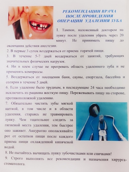 Как вырвать молочный зуб правильно в домашних условиях | za-rozhdenie.ru